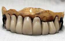 تاریخچه ساخت دندان مصنوعی