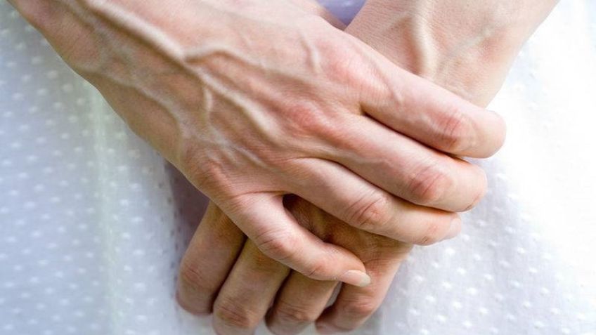 علت پیر به نظر رسیدن پوست دست ها و راه درمان آن