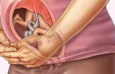 لگد زدن جنین چه موقع شروع می شود