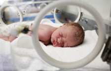 با زایمان زودرس چه مشکلاتی ایجاد می شود