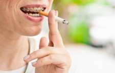 اثرات مخرب سیگار بر دهان و دندان
