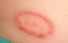 چه افرادی بیشتر دچار عفونت می شوند