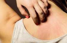 دلایل خارش بدن  و درمان طبیعی آن