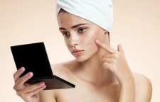 درمان مشکلات پوستی دوران بلوغ در نوجوانان