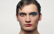 چگونگی انجام جراحی تغییر جنسیت SRS در ترنس ها