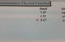 تشخیص هر آنچه که در نتایج آزمایش تیروئید نوشته شده