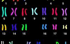 آزمایش کاریوتایپ یا تشخیص ژنتیک قبل بارداری