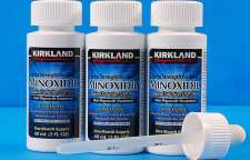 تأثیر محلول ماینوکسیدیل بر درمان ریزش مو و رویش مجدد موی سر و ریش صورت