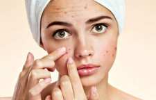 علت ایجاد آکنه و جوش صورت