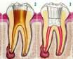 هر دندان چند کانال و ریشه دارد