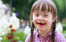 در مورد بیماری سندروم داون بدانیم