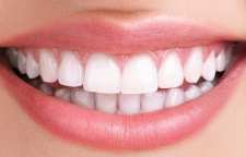 با روش های اصلاح طرح لبخند آشنا شویم