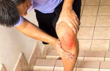 دلایل درد زانو در سنین جوانی را بدانیم