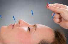 استفاده از طب سوزنی برای سفت شدن و لیفتینگ پوست صورت