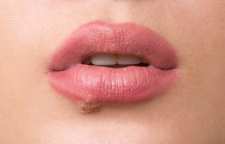 چه زمانی بیشتر تبخال می زنیم