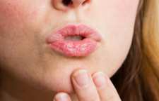 روش های خانگی برای پیشگیری و درمان خشکی لب