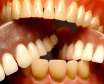 مشکلات دندانی و عوارض آن