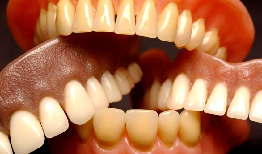 مشکلات دندانی و عوارض آن