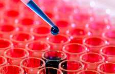 علائم و نشانه های سرطان خون را بشناسیم