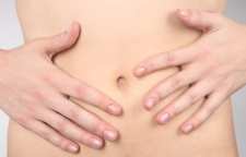 بیماری سینوس نافی