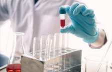 تست غربالگری NIPT چیست و چه کاربردی دارد