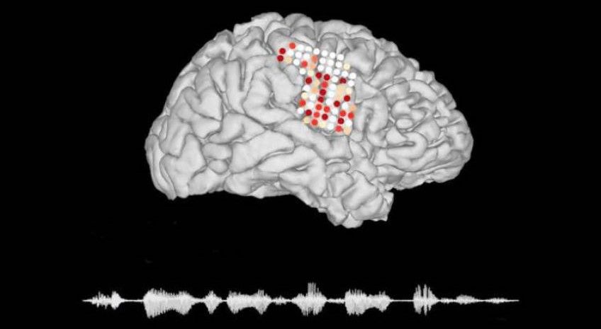 دانشمندان سیگنال های مغز را به گفتار تبدیل کردند