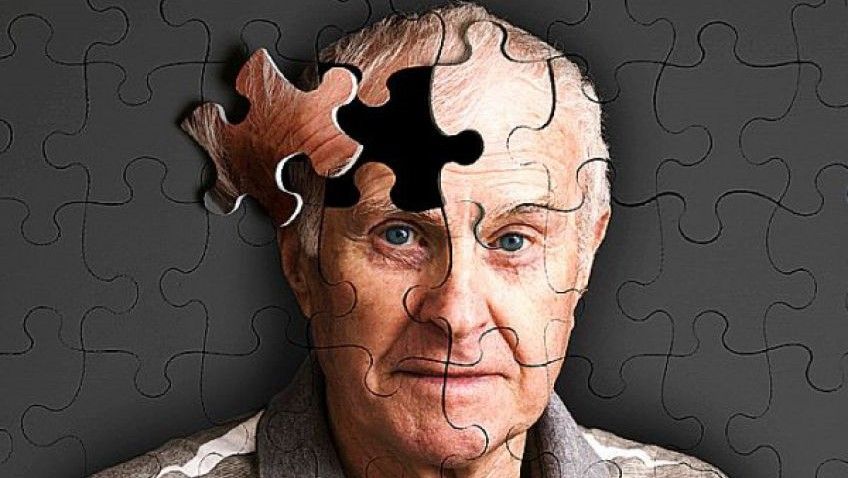 بیماری آلزایمر و روش های پیشگیری و درمان آن
