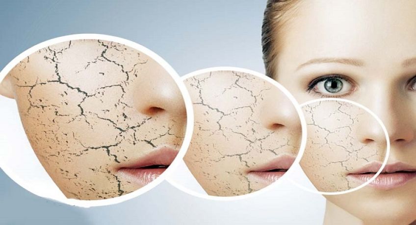 علت خشکی پوست صورت و راه های درمان آن