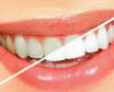 14 راه فوری و طبیعی سفید کردن دندان ها به روش خانگی
