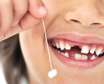 نکات جالبی که باید در مورد نگهداری دندان شیری بدانید