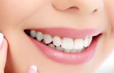 معرفی روش های زیبایی دندانپزشکی