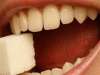 ارتباط بهداشت دندان ها با قندخون