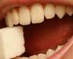 ارتباط بهداشت دندان ها با قندخون