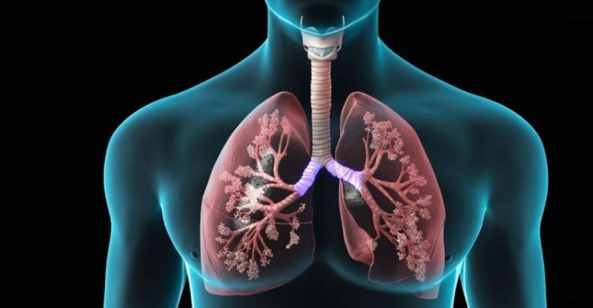 چگونه درد ریه را تشخیص دهیم
