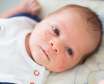 علائم و راه های درمان جوش صورت نوزاد
