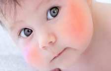 علائم و علت ایجاد بیماری پنجم یا اریتما اینفکتیوزوم