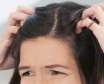 چرا ریشه موی سر درد می گیرد