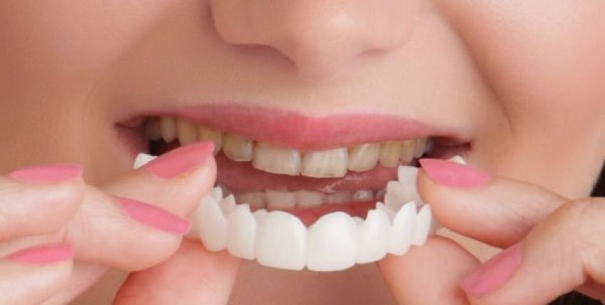 کاور دندان چیست و چه کاربردی دارد