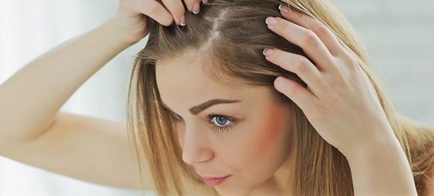 بیماری مروارید مو چیست و درمان این بیماری چگونه است